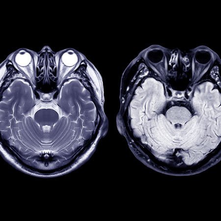 Xenon Isotope Image